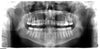 X Ray