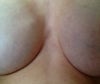 Visible edging and fold of my right breast implant-no contracture-breast is soft