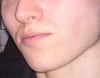 Notice the bump around the mouth and how it makes the cheeks look less prominent?
