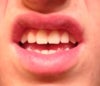 Do I have short teeth?