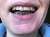 mouth open