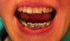mouth open