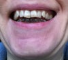 mouth closed