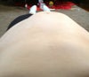 this buldge is umbilicle and above. It happens whenever I tighten my stomach.
