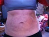 2 years after Lipo.