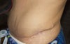 Dog ear? Or normal swelling? I have another photo front view if it would show better?