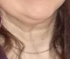 Chin/neck