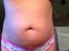 Pre lipo