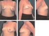 Before surgery