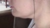 side view, head straight
