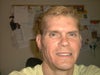 This photo was taken the day before Juvederm was injected under both eyes.  I had only wanted one wrinkled traced with Juvederm that was next to my right eye, and visible, only when I smiled.