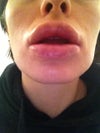 morning after operation