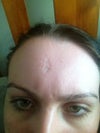 these are my three scars
