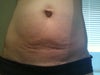 Close up you can see c-section scar just above panty line.