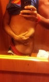 there is so much lose skin on my flanks and back .. it sticks out like crazy