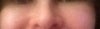 My left side is swollen compared to the right side