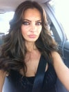 Bedore the Juvederm injection. I had nice cheekbones.