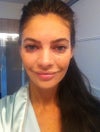 2 weeks past the Juvederm injection