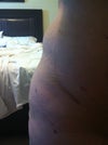 Closer up of my lump