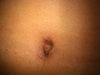 My belly button