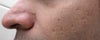 nose + left cheek