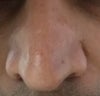 nose