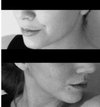 Left Profile (Top) - Right Profile (Bottom) - I know I'm smiling slightly in the top and the angle is slightly different but it looks this way regardless. The right profile's jaw does not have an appealing shape and over all the profile is less 'full' and shapely than the left - from the nostrils to the cheeks and eyebrows, but most significantly the nostrils and jaw.
