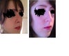 right angle photo (Before nose job on the Right)