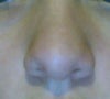 my nose