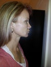 Right side