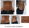 This is my tummy following childbirth. I had diastasis recti and an umbilical hernia.