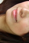 my chin