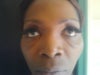 BEFORE SURGERY