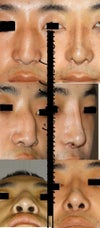 before after pic by the doctor.