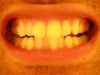 Front view, please disregard the bottom row