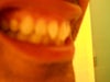 Right side, please take notice of the front tooth. It's the only one misaligned of the top row