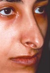 my nose type