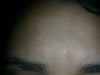 this is my forehead