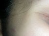 pic of the skin around my eye while smiling