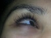 my eye skin