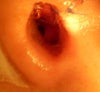 Another image of semi-blocked nostril