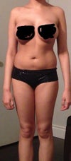 Front view. I have a lot of fat in my (upper body) stomach and back