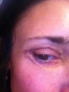 Left eye corner