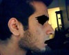 Right Profile - Hump, possibly overprojection as well
