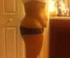 Side picture... I am scared to disfigure my belly.