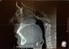 Recent X-Ray my ortho took for me