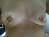 6 weeks post explant