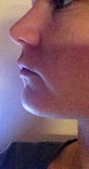 Side view 2