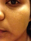 Freckles/skin tags/ moles/I don't really know what to call it