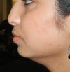 chin before
